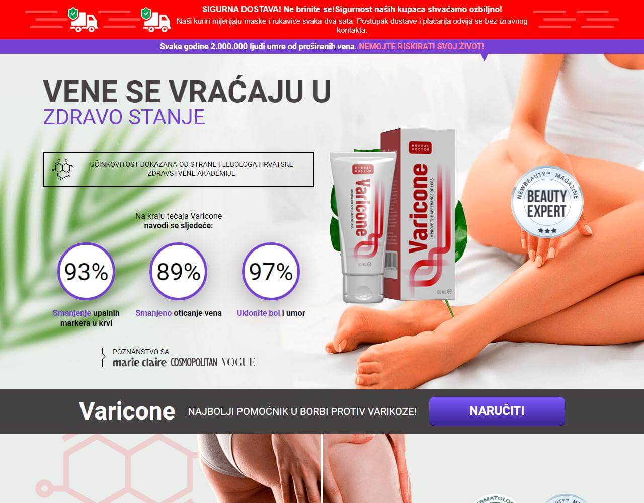 Varicone 1